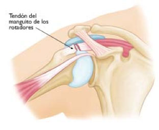 imagenes de astroscopia de hombro
