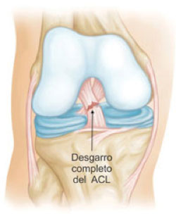 imagen de rodilla
