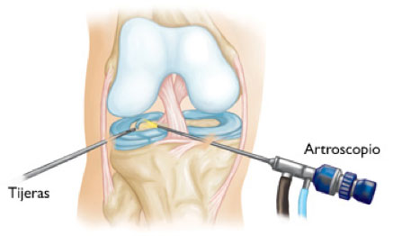 imagenes de rodilla