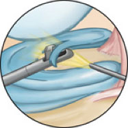  imagenes de rodilla